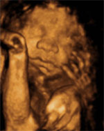 Billede af baby fra 3D scanning i Silkeborg